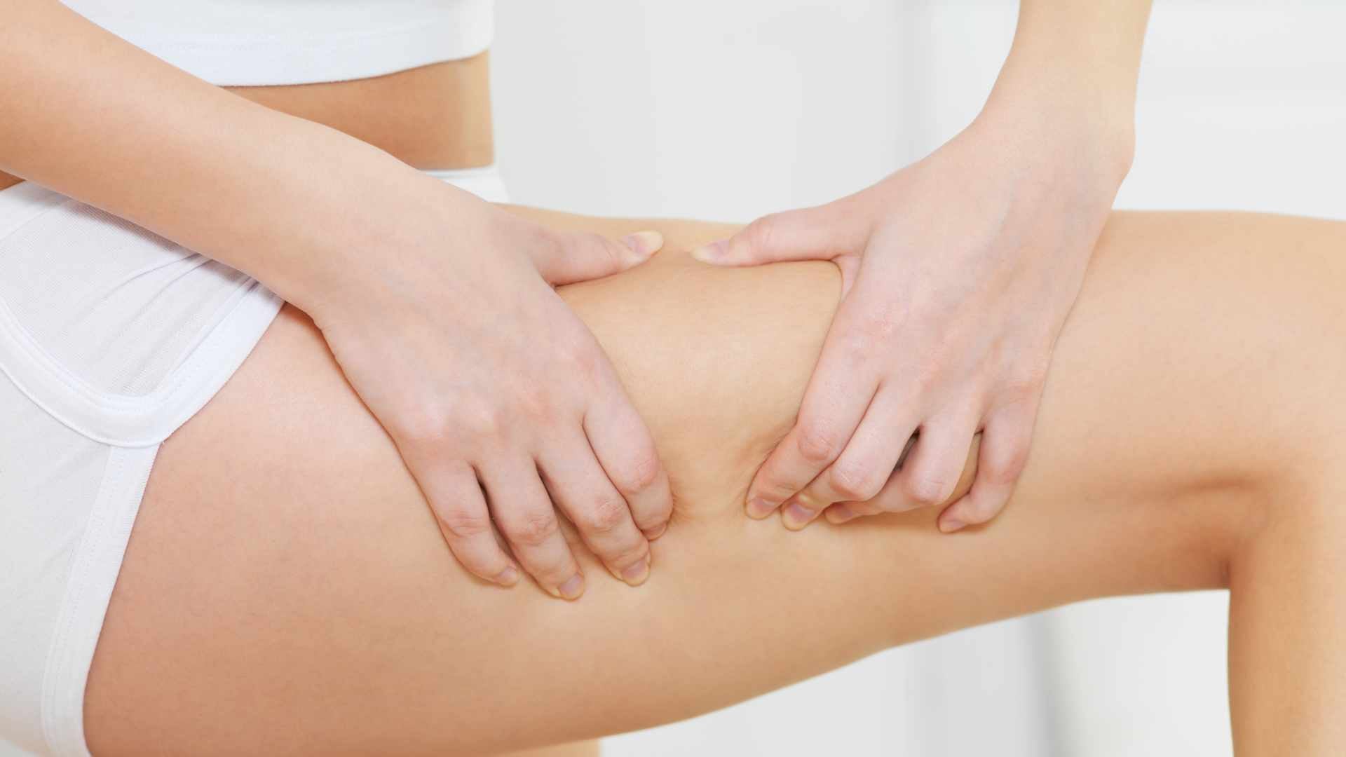 Red Light Therapy for Cellulite (What’s the Connection?)